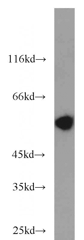 mouse colon tissue were subjected to SDS PAGE followed by western blot with Catalog No:113716(PRPH antibody) at dilution of 1:2000