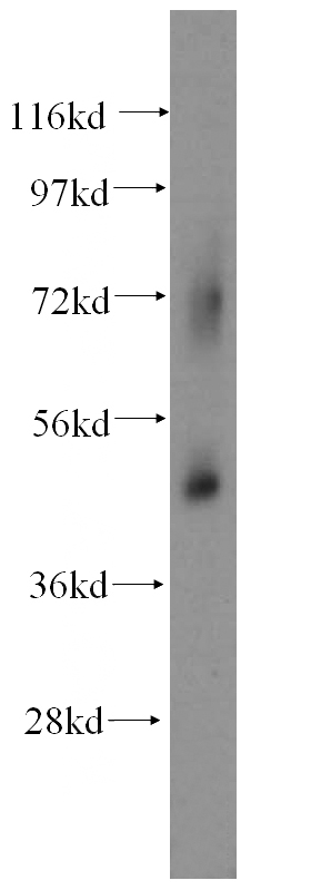 human heart tissue were subjected to SDS PAGE followed by western blot with Catalog No:115820(SUCLG2 antibody) at dilution of 1:500