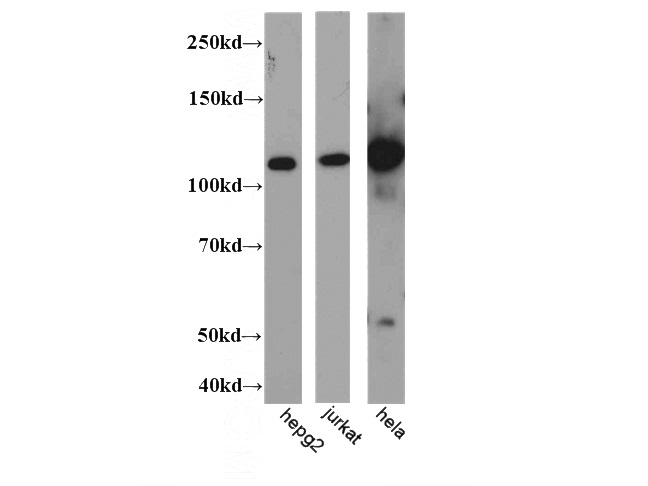 WB result of Catalog No:112048(KIF5B antibody).
