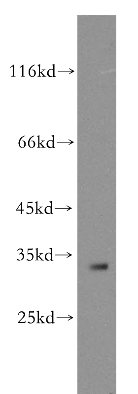 MCF7 cells were subjected to SDS PAGE followed by western blot with Catalog No:111685(IGFBP2 antibody) at dilution of 1:300