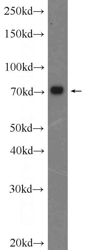 HeLa cells were subjected to SDS PAGE followed by western blot with Catalog No:108613(C17orf85 Antibody) at dilution of 1:1000