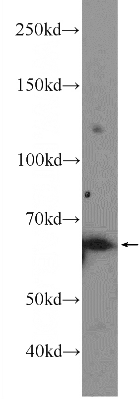 HeLa cells were subjected to SDS PAGE followed by western blot with Catalog No:114764(RNF8 Antibody) at dilution of 1:600