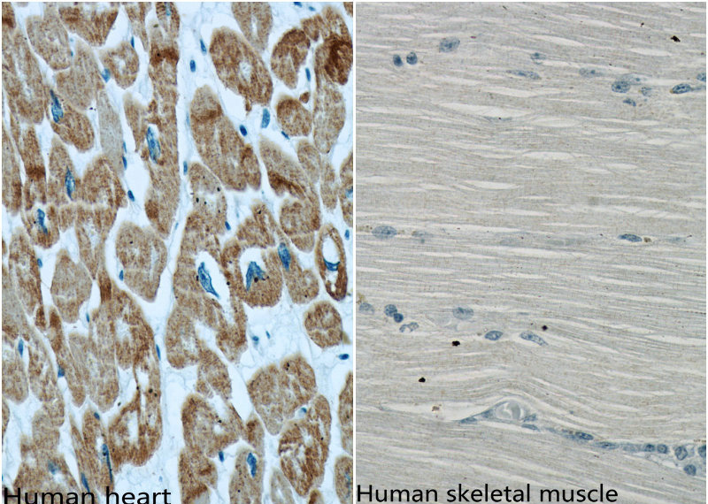 Immunohistochemistry of paraffin-embedded human heart and human skeletal muscle using Catalog No:107575 (ACTC1 specific antibody) at dilution 1:500. (under 40x lens)