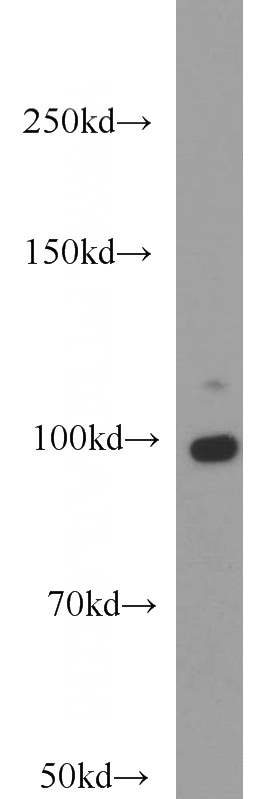 HL-60 cells were subjected to SDS PAGE followed by western blot with Catalog No:109963(DNM2 antibody) at dilution of 1:500