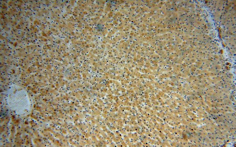 Immunohistochemical of paraffin-embedded human liver using Catalog No:112902(MUT antibody) at dilution of 1:100 (under 10x lens)