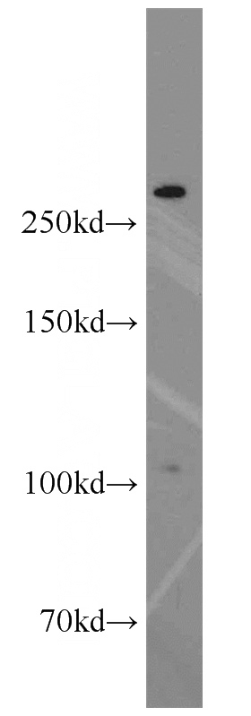 COLO 320 cells were subjected to SDS PAGE followed by western blot with Catalog No:116987(XIRP2 antibody) at dilution of 1:500