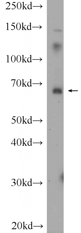 COLO 320 cells were subjected to SDS PAGE followed by western blot with Catalog No:117106(BCMO1 Antibody) at dilution of 1:300
