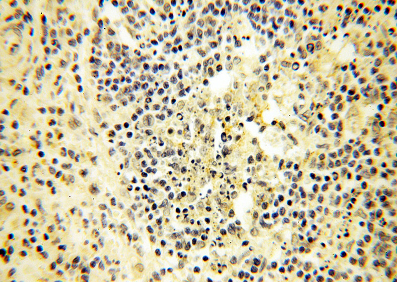 Immunohistochemical of paraffin-embedded human spleen using Catalog No:113769(PFKFB2 antibody) at dilution of 1:100 (under 40x lens)