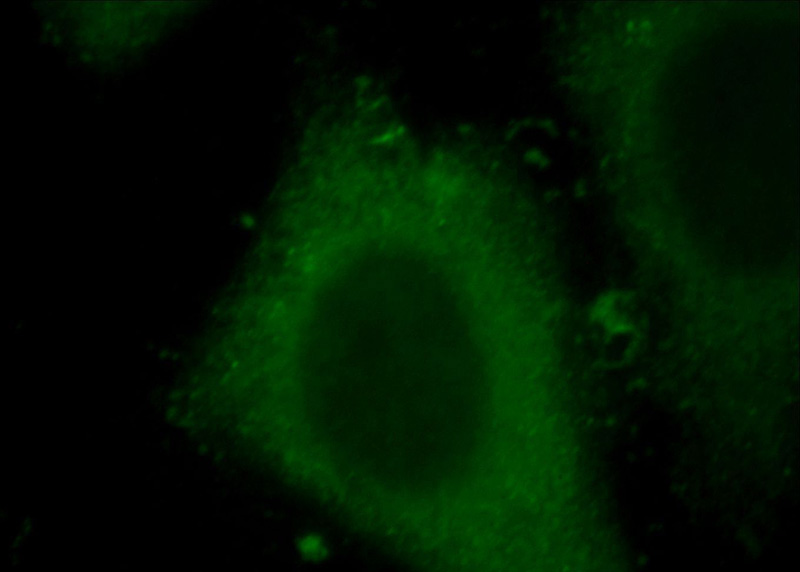 Immunofluorescent analysis of HepG2 cells, using IL20RB antibody Catalog No:111776 at 1:25 dilution and FITC- labeled goat anti-Rabbit IgG (green).