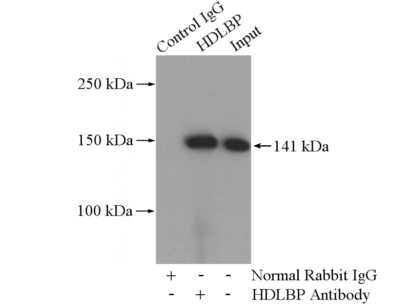 IP Result of anti-HDLBP (IP:Catalog No:111390, 4ug; Detection:Catalog No:111390 1:500) with Jurkat cells lysate 2400ug.