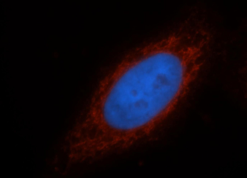 Immunofluorescent analysis of HepG2 cells, using ATF6B antibody Catalog No:108287 at 1:25 dilution and Rhodamine-labeled goat anti-rabbit IgG (red). Blue pseudocolor = DAPI (fluorescent DNA dye).