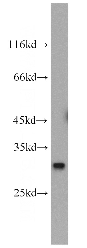 mouse liver tissue were subjected to SDS PAGE followed by western blot with Catalog No:114366(QDPR antibody) at dilution of 1:1000