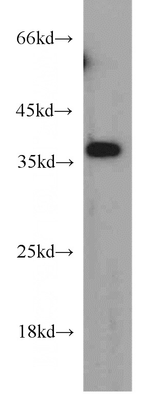 human placenta tissue were subjected to SDS PAGE followed by western blot with Catalog No:112380(MAGEA4 antibody) at dilution of 1:300