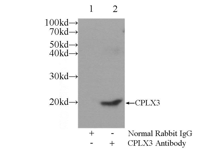 IP Result of anti-CPLX3 (IP:Catalog No:109512, 3ug; Detection:Catalog No:109512 1:300) with mouse brain tissue lysate 6000ug.