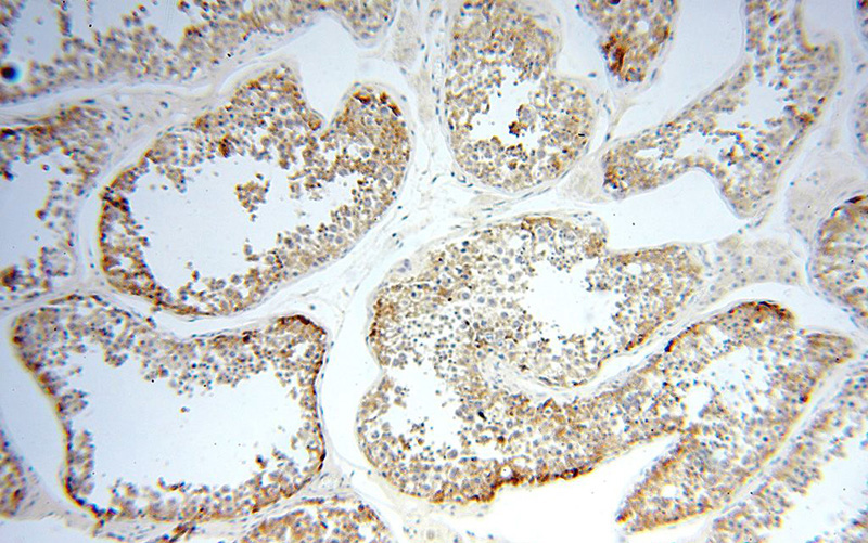 Immunohistochemical of paraffin-embedded human testis using Catalog No:113525(OXCT2 antibody) at dilution of 1:100 (under 10x lens)