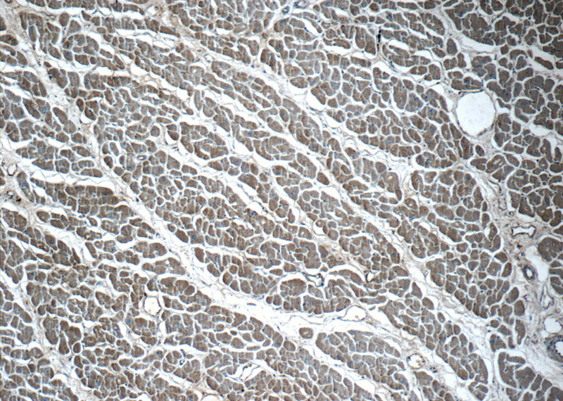 Immunohistochemistry of paraffin-embedded human heart tissue slide using Catalog No:116706(VAMP3 Antibody) at dilution of 1:50 (under 10x lens)