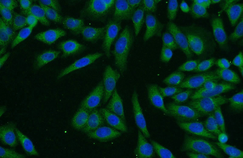 Immunofluorescent analysis of HeLa cells using Catalog No:113601(PASK Antibody) at dilution of 1:25 and Alexa Fluor 488-congugated AffiniPure Goat Anti-Rabbit IgG(H+L)