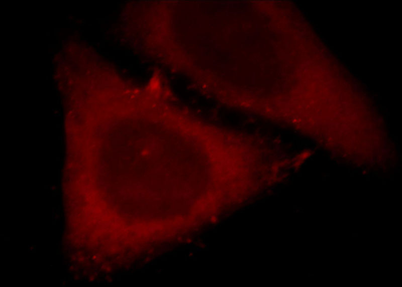 Immunofluorescent analysis of HepG2 cells, using MAS1L antibody Catalog No:112486 at 1:25 dilution and Rhodamine-labeled goat anti-rabbit IgG (red).