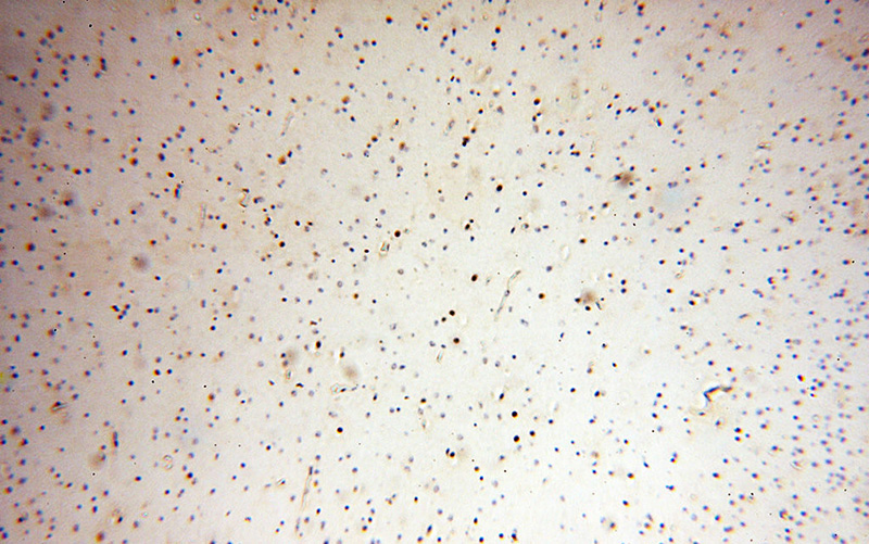 Immunohistochemical of paraffin-embedded human brain using Catalog No:113052(NDC80 antibody) at dilution of 1:100 (under 10x lens)