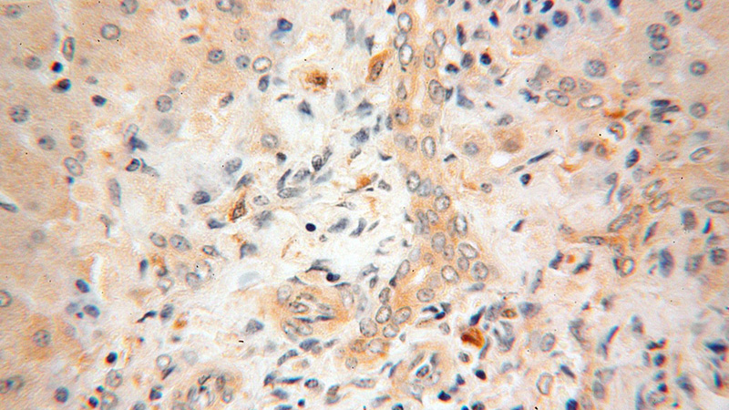 Immunohistochemical of paraffin-embedded human liver using Catalog No:114879(RPL23A antibody) at dilution of 1:100 (under 40x lens)