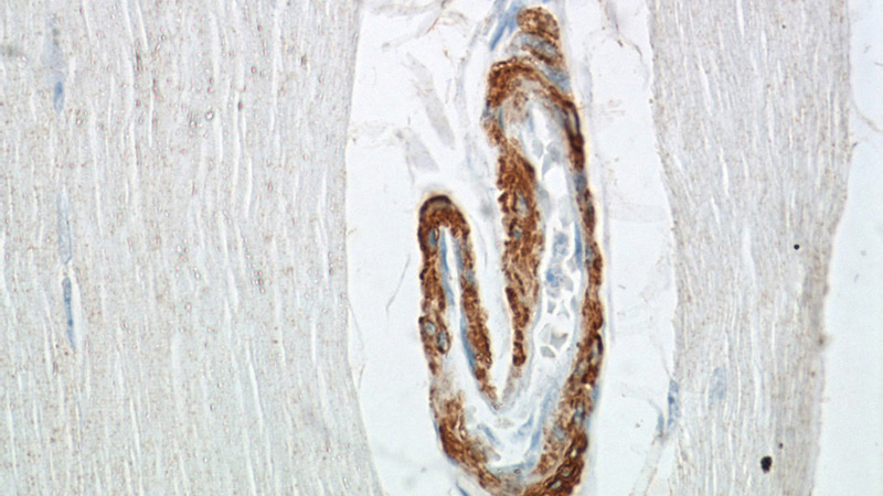 Immunohistochemical of paraffin-embedded human skeletal muscle using Catalog No:115391(MYH11 antibody) at dilution of 1:50 (under 40x lens)