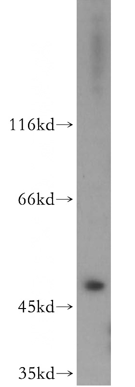 HeLa cells were subjected to SDS PAGE followed by western blot with Catalog No:110194(EIF3E antibody) at dilution of 1:500