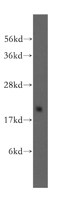 HeLa cells were subjected to SDS PAGE followed by western blot with Catalog No:110940(GEMIN6 antibody) at dilution of 1:500