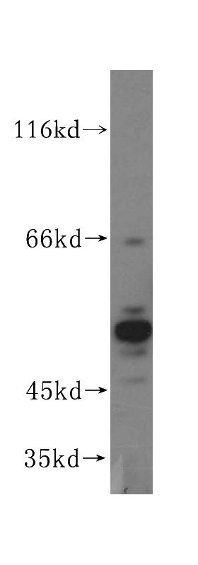 HeLa cells were subjected to SDS PAGE followed by western blot with Catalog No:111065(GPKOW antibody) at dilution of 1:500