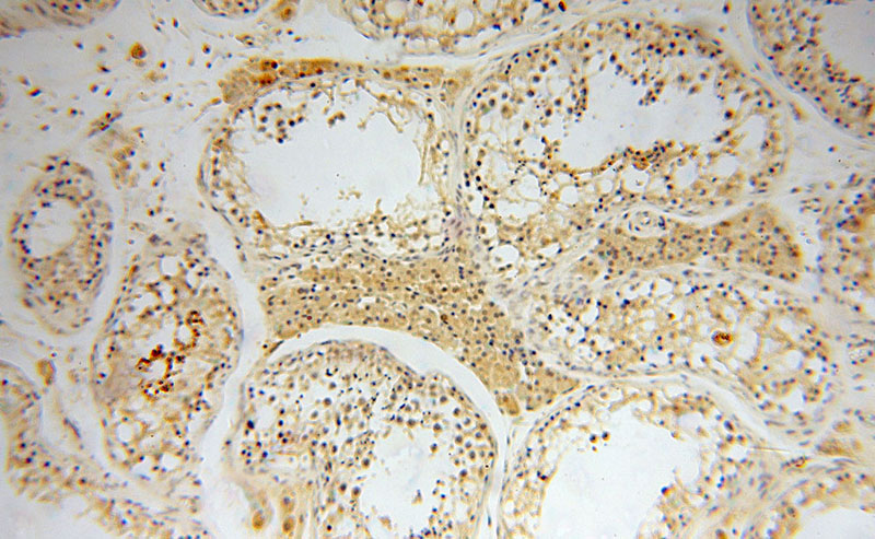 Immunohistochemical of paraffin-embedded human testis using Catalog No:113454(NXN antibody) at dilution of 1:50 (under 10x lens)