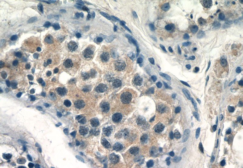 Immunohistochemistry of paraffin-embedded human testis tissue slide using Catalog No:108907(CALR3 Antibody) at dilution of 1:50 (under 40x lens)