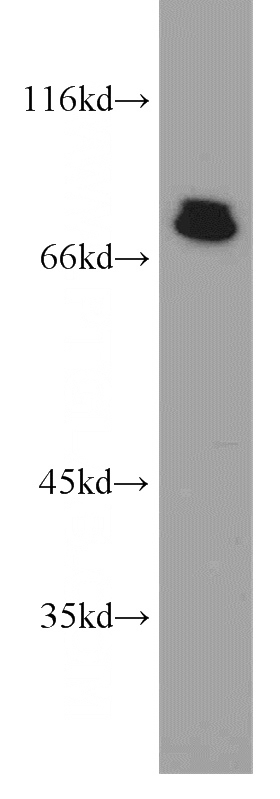 K-562 cells were subjected to SDS PAGE followed by western blot with Catalog No:108191(ARID3A antibody) at dilution of 1:1500