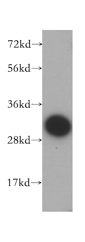 HeLa cells were subjected to SDS PAGE followed by western blot with Catalog No:108748(CA3 antibody) at dilution of 1:500