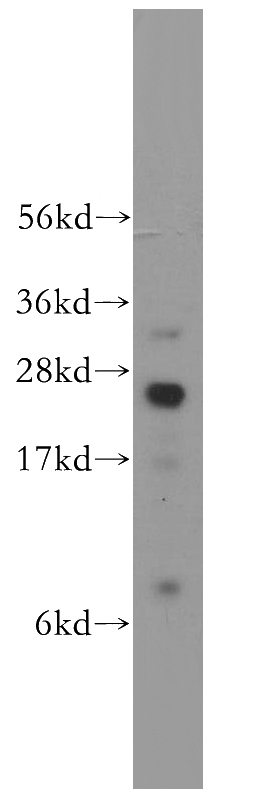 human spleen tissue were subjected to SDS PAGE followed by western blot with Catalog No:114920(RRAS antibody) at dilution of 1:500