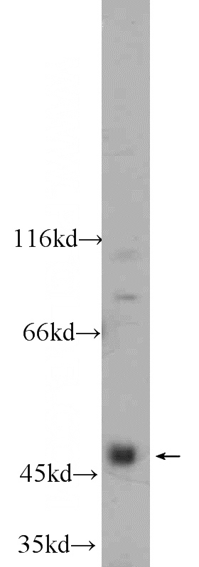 HeLa cells were subjected to SDS PAGE followed by western blot with Catalog No:113102(NEK2 antibody) at dilution of 1:800