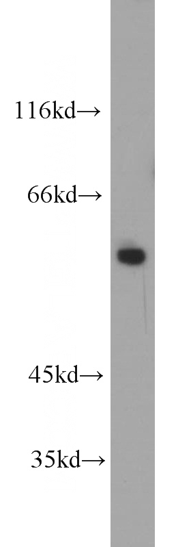 HEK-293 cells were subjected to SDS PAGE followed by western blot with Catalog No:110556(FBXO5 antibody) at dilution of 1:800