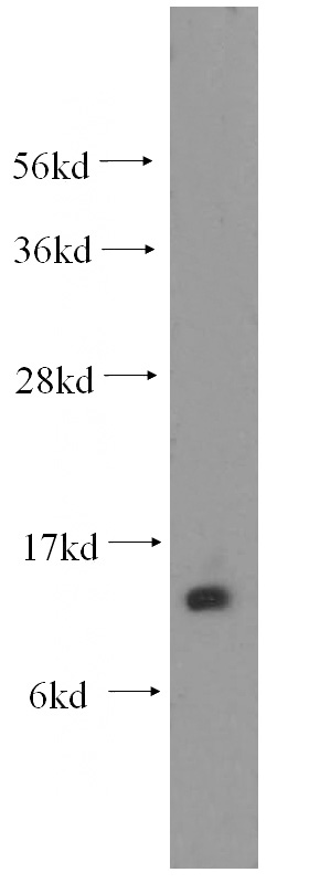 human heart tissue were subjected to SDS PAGE followed by western blot with Catalog No:110436(FABP1 antibody) at dilution of 1:700