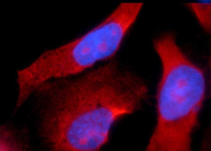 Immunofluorescent analysis of A431 cells using Catalog No:108959(CCDC104 Antibody) at dilution of 1:25 and Rhodamine-Goat anti-Rabbit IgG