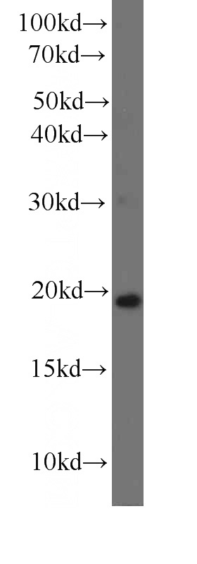 HepG2 cells were subjected to SDS PAGE followed by western blot with Catalog No:107403(IL7 antibody) at dilution of 1:1000