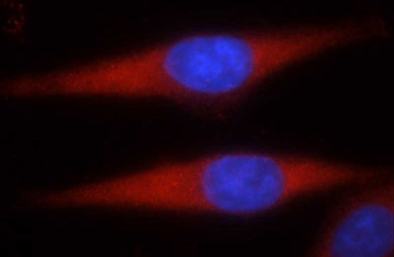 Immunofluorescent analysis of HepG2 cells using Catalog No:115725(STK4 Antibody) at dilution of 1:50 and and Rhodamine-labeled goat anti-rabbit IgG (red).