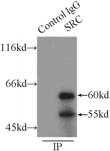 IP Result of anti-SRC (IP:Catalog No:115665, 5ug; Detection:Catalog No:115665 1:1000) with SH-SY5Y cells lysate 2900ug.