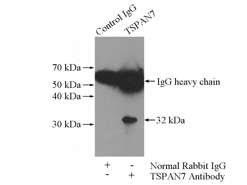 IP Result of anti-TSPAN7 (IP:Catalog No:116365, 4ug; Detection:Catalog No:116365 1:500) with K-562 cells lysate 3600ug.