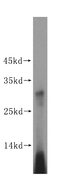 human brain tissue were subjected to SDS PAGE followed by western blot with Catalog No:112842(MRPS15 antibody) at dilution of 1:500