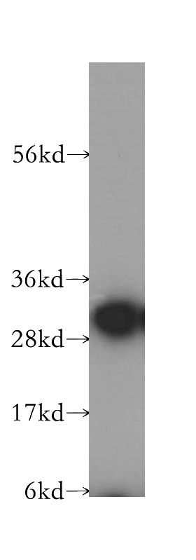 human brain tissue were subjected to SDS PAGE followed by western blot with Catalog No:108843(CAPZA1 antibody) at dilution of 1:400