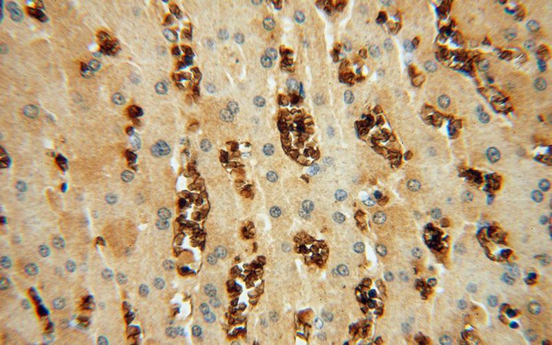Immunohistochemical of paraffin-embedded human liver using Catalog No:111272(HBQ1 antibody) at dilution of 1:50 (under 40x lens)