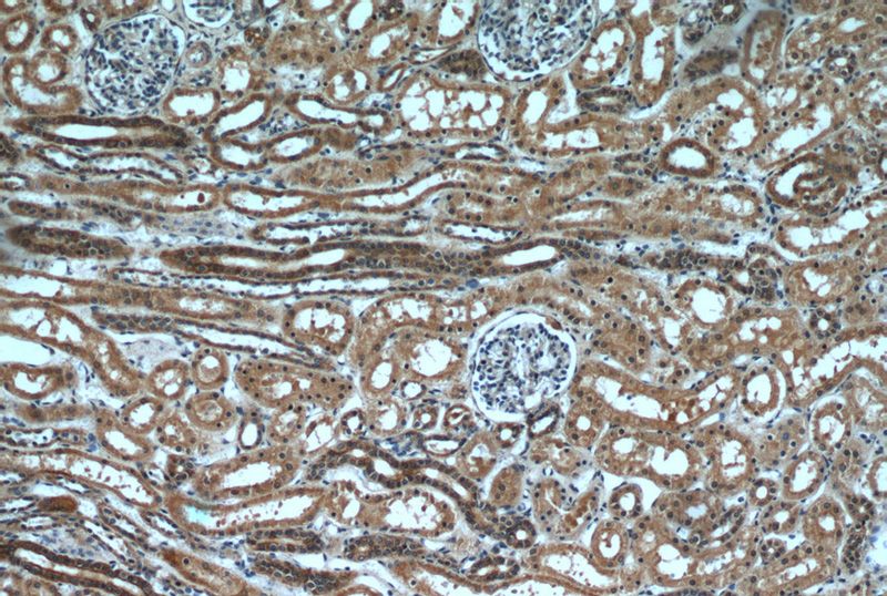 Immunohistochemical of paraffin-embedded human kidney using Catalog No:111335(hamartin antibody) at dilution of 1:50 (under 10x lens)