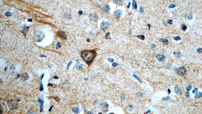 Immunohistochemistry of paraffin-embedded human brain slide using Catalog No:108360(Barkor Antibody) at dilution of 1:50 (under 40x lens)