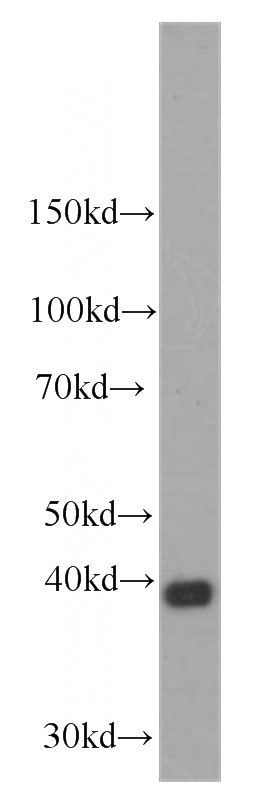 HEK-293 cells were subjected to SDS PAGE followed by western blot with Catalog No:107605(STC2 antibody) at dilution of 1:1000