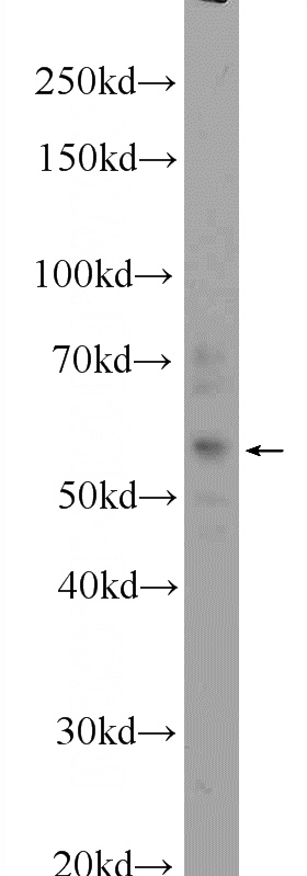 HepG2 cells were subjected to SDS PAGE followed by western blot with (ZFP2 Antibody) at dilution of 1:1000