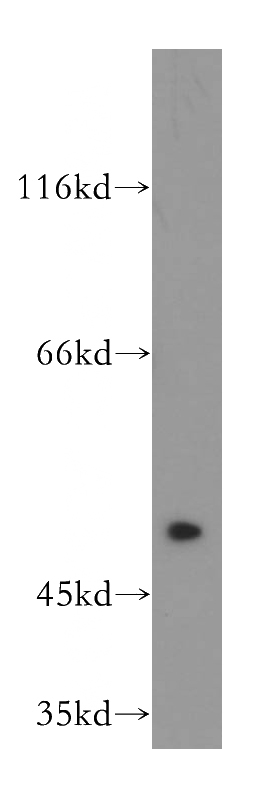 mouse heart tissue were subjected to SDS PAGE followed by western blot with Catalog No:110640(FGFR1OP antibody) at dilution of 1:800