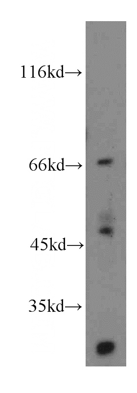 HepG2 cells were subjected to SDS PAGE followed by western blot with Catalog No:112674(MLF1IP antibody) at dilution of 1:500